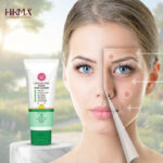 Acne Solution Face Wash - Image 3